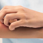 Jeukwoorden en andere irritatieverhogende uitdrukkingen